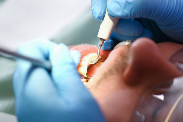  Park Layne, OH Emergency Dentist Pros