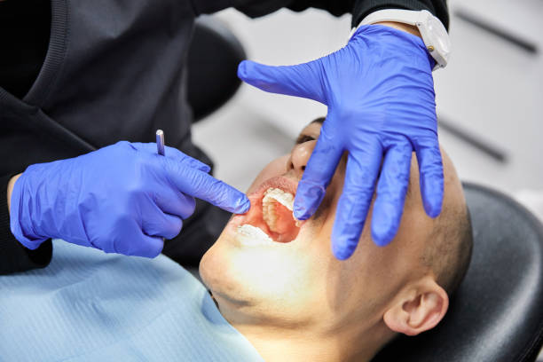 Best Emergency Dentist for Lost Fillings or Crowns in Park Layne, OH