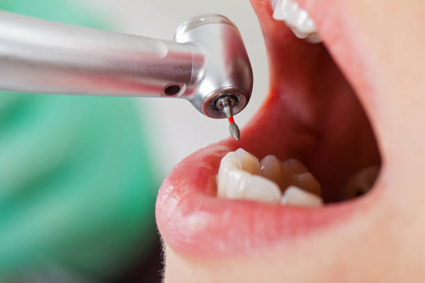 Best Mobile Emergency Dentist in Park Layne, OH